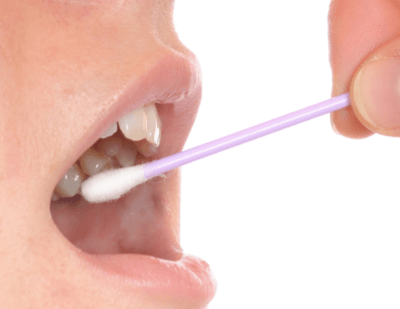 口腔内の細胞を綿棒で採取する