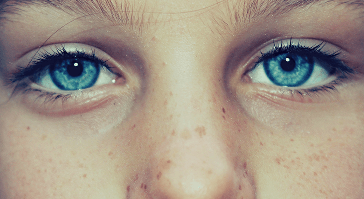青い目のそばかす顔
